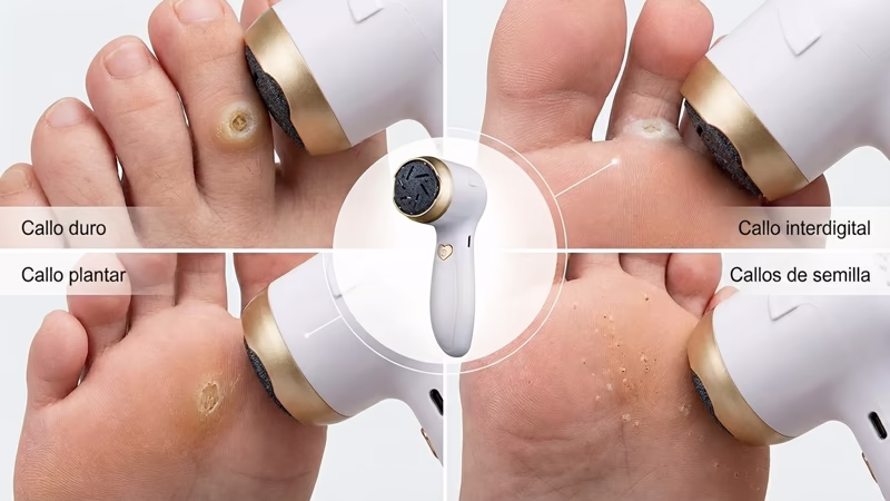 Como Usar el Quita Callos: Guia Practica para Eliminar Callos en Casa. 4 Quita callos eléctrico actuando sobre cuatro tipos de callos: duro, interdigital, plantar y de semilla